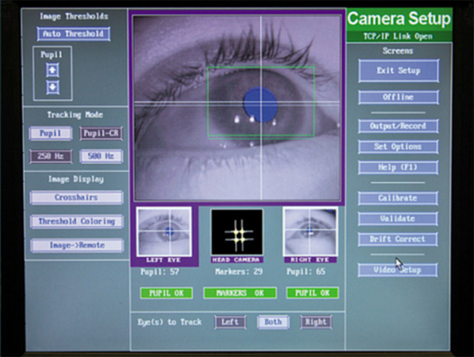 A picture of Dr. Baron's eye tracking software.